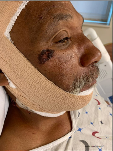 Don Hanna was treated at Shock Trauma in Baltimore after his June 2020 arrest.